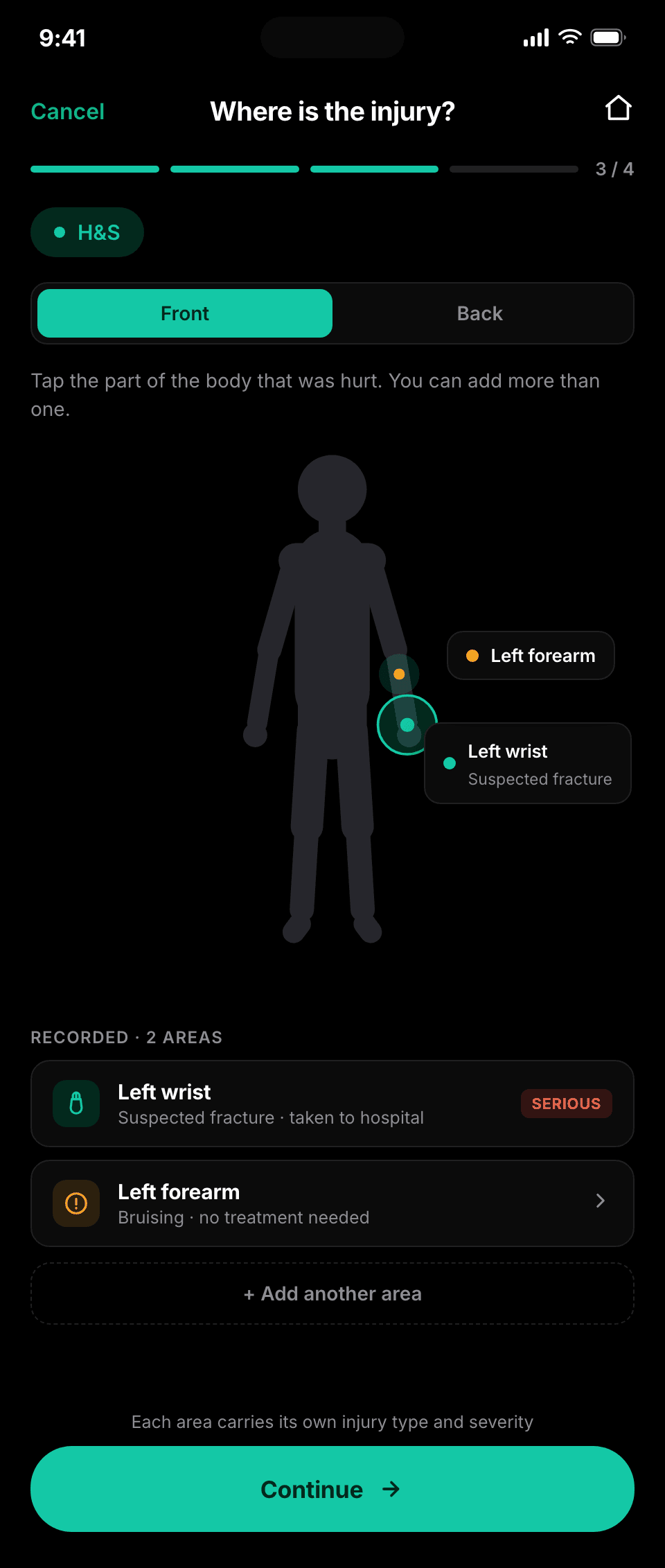 Marking an injury on a body schematic